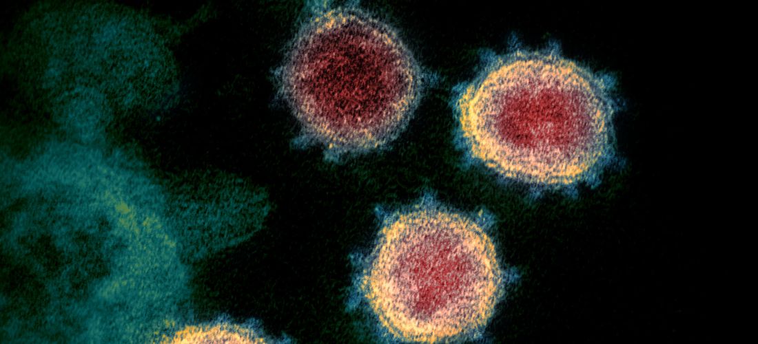 Das Foto zeigt SARS-CoV-2 unter dem Mikroskop. Es sind drei rundliche Viren zu sehen. In der Mitte sind sie rot an den Rändern gelb. Sie haben einen zackenartigen Umriss.